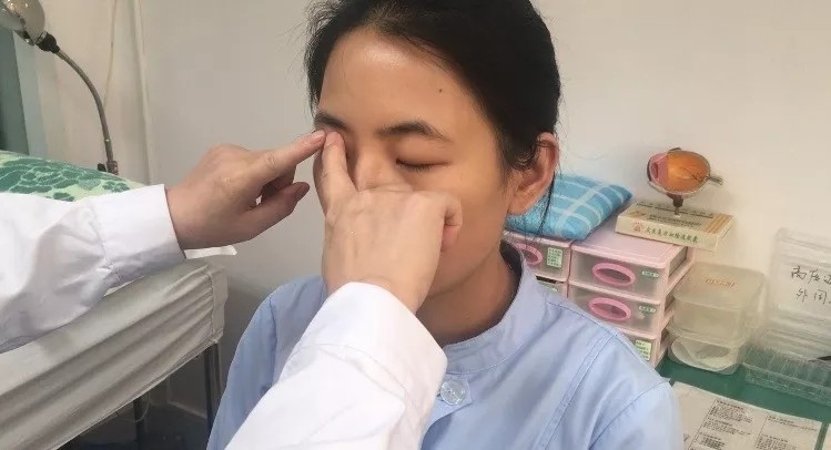 眼睛脹痛是不是眼壓過高 指測法 2秒就能判斷 眼部 科別 元氣網