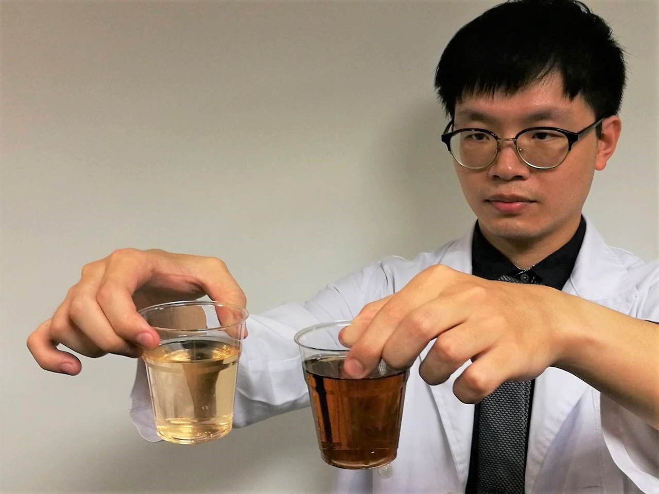 不同顏色對應不同疾病 尿液自我檢測表 看健康 健康知識 新聞 元氣網