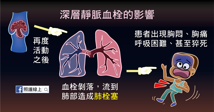 腳腫痛演變成血栓猝死 搭機旅客死亡常是因為它 心臟血管 科別 元氣網