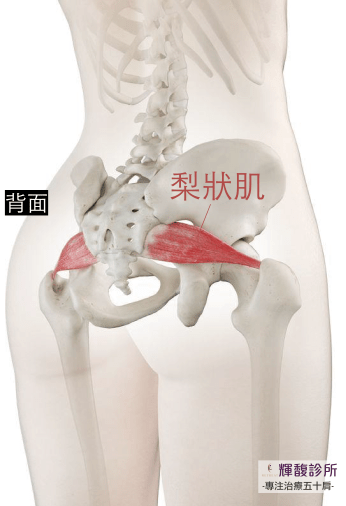 臀部好痛 不是坐骨神經痛 是 梨狀肌症候群 骨科 復健 科別 元氣網