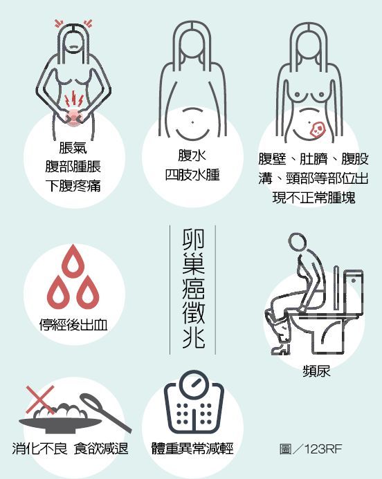 元氣大數據 三大婦癌同時發生 與這兩大基因有關 生活新聞 生活 聯合新聞網