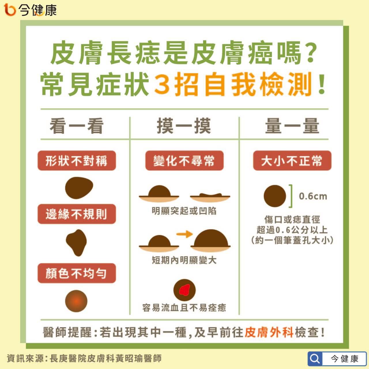 皮膚長痣是皮膚癌嗎 常見症狀 簡單3招自我檢測 皮膚癌 癌症 元氣網