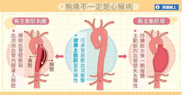 å¿è¡ç®¡ç¾ç
åé¡å¤é«å¸«ææ¥å¸¸ä¿é¤è¡ç®¡é樣å| å¿èè¡ç®¡| ç§å¥| å
氣網