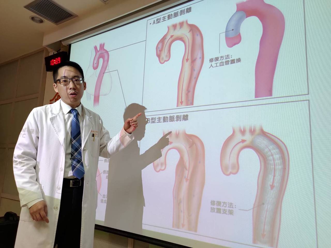 長庚研究 主動脈剝離半數與家族史有關風險增6 82倍 心臟血管 科別 元氣網