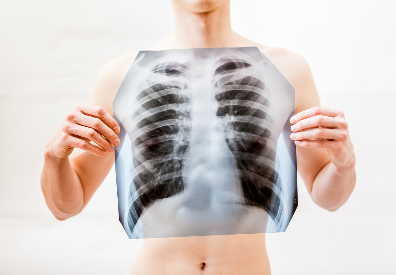 會呼吸的痛 隨著年紀增長 肋骨骨折 每多斷一根死亡率增加 骨科 復健 科別 元氣網