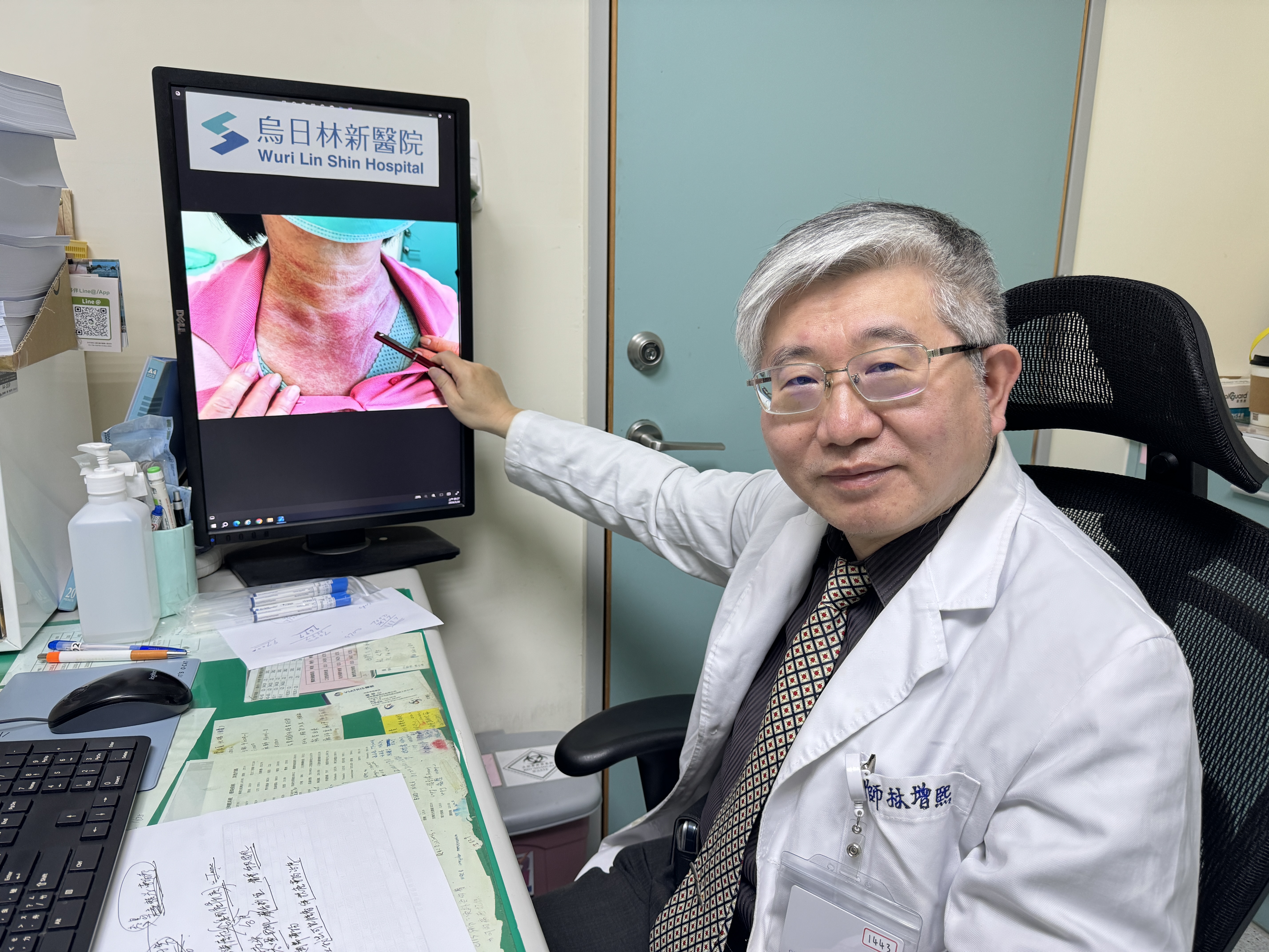 乌日林新医院血液肿瘤科医师林增熙说，皮肌炎平均好发年龄约40～50岁。图／乌日林新医院提供