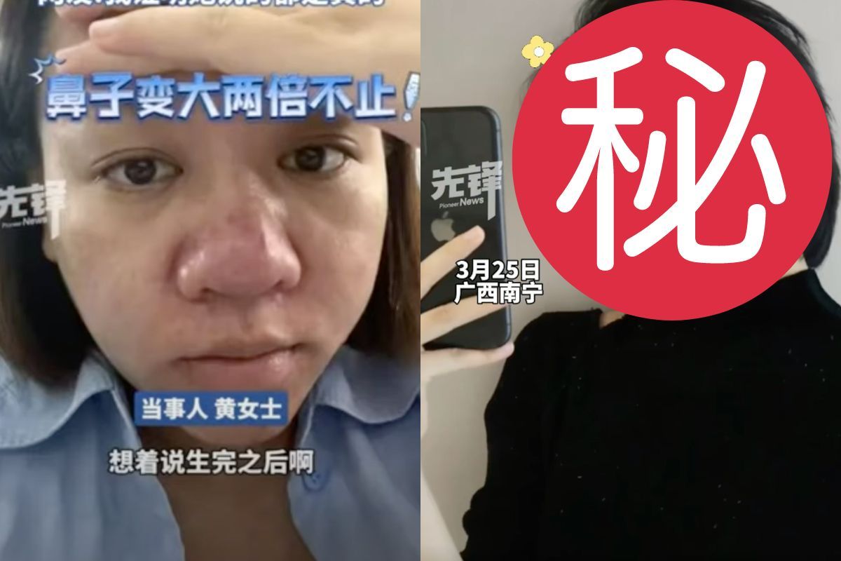 大陆一位女士怀孕后体重暴涨28斤（14公斤），脸上冒出许多痘痘粉刺，鼻子更是变大了两倍。图／撷自Youtube