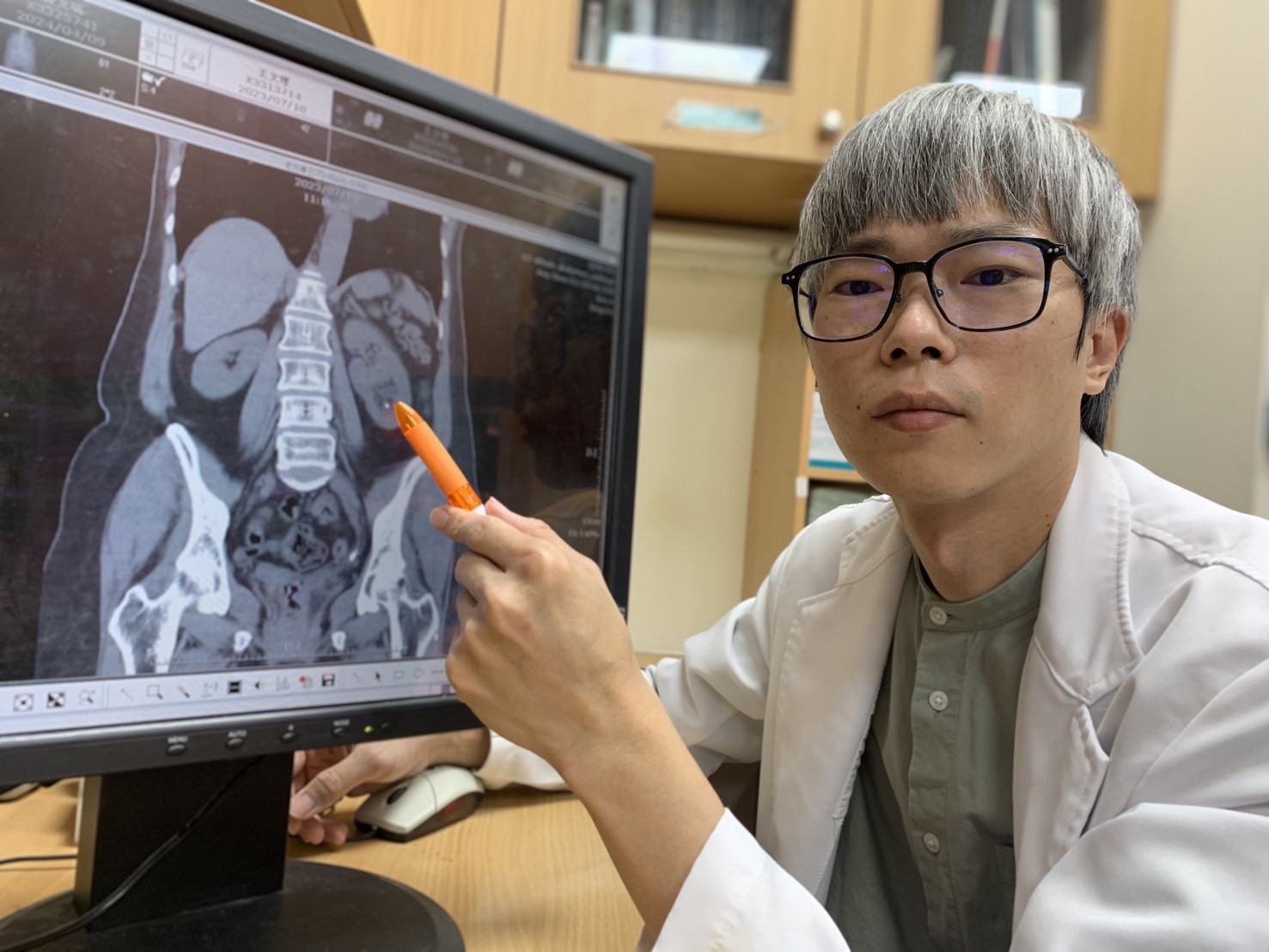 医师赵浩坚说明，张妇左侧有两颗肾脏及两条完整的输尿管，称为「单侧双套集尿系统」，先天有3颗肾脏。图／卫福部台中医院提供