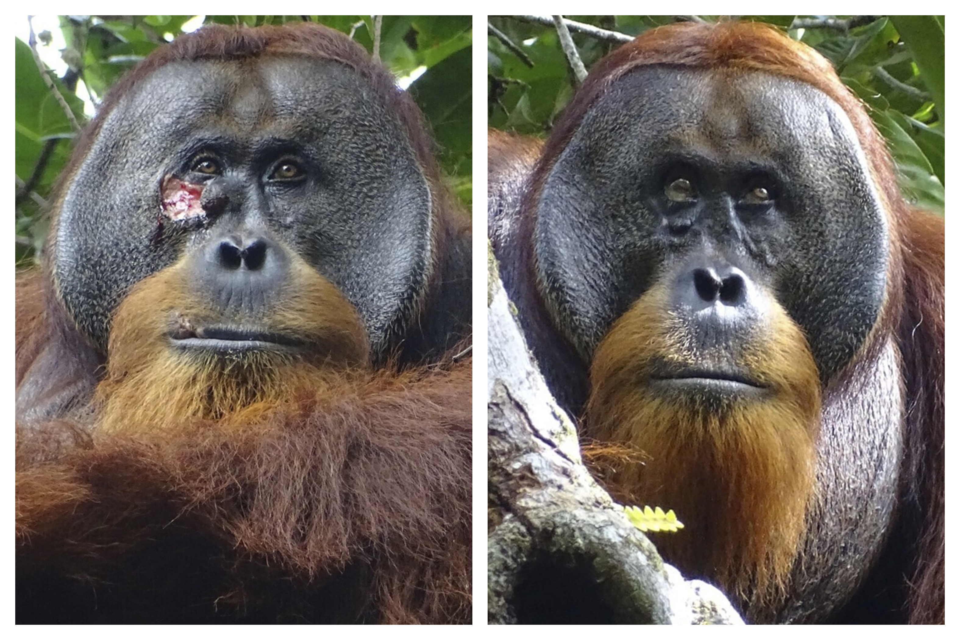 印尼一只雄性苏门答腊红毛猩猩用植物自制药膏，并反复涂抹在脸上的伤口，1个月后伤口痊愈。美联社