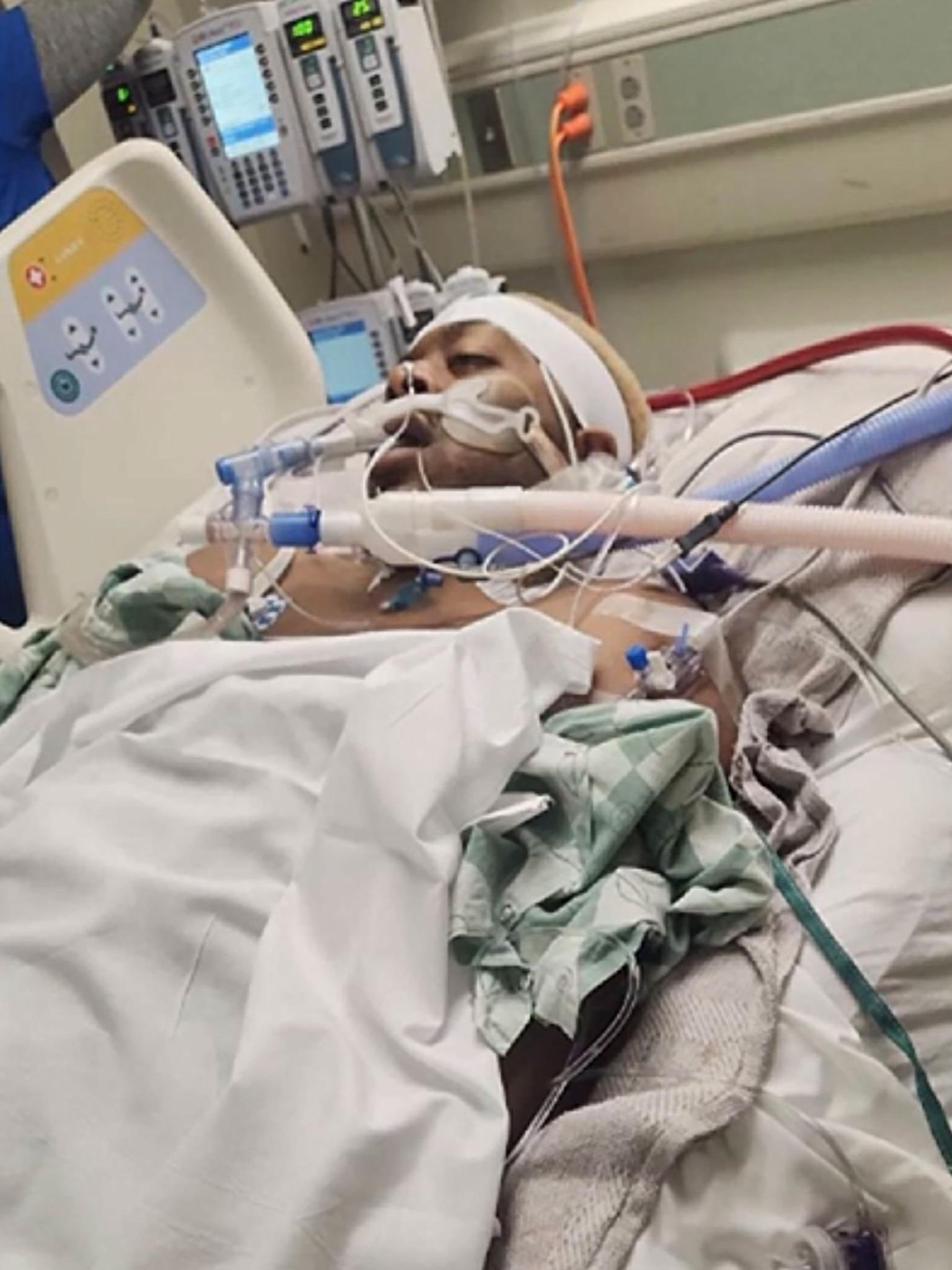 美国路易斯安那州26岁医学生吉尔伯特上月遭恶作剧推入水中，同行友人任令他自生自灭将近20分钟，送医后一度濒临脑死。所幸目前已恢复意识，依靠呼吸器维持生命。取自X