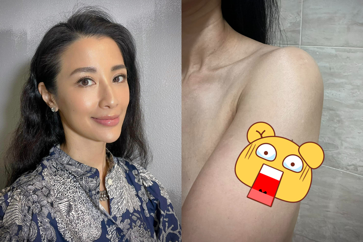 李蒨蓉手臂遭割伤。