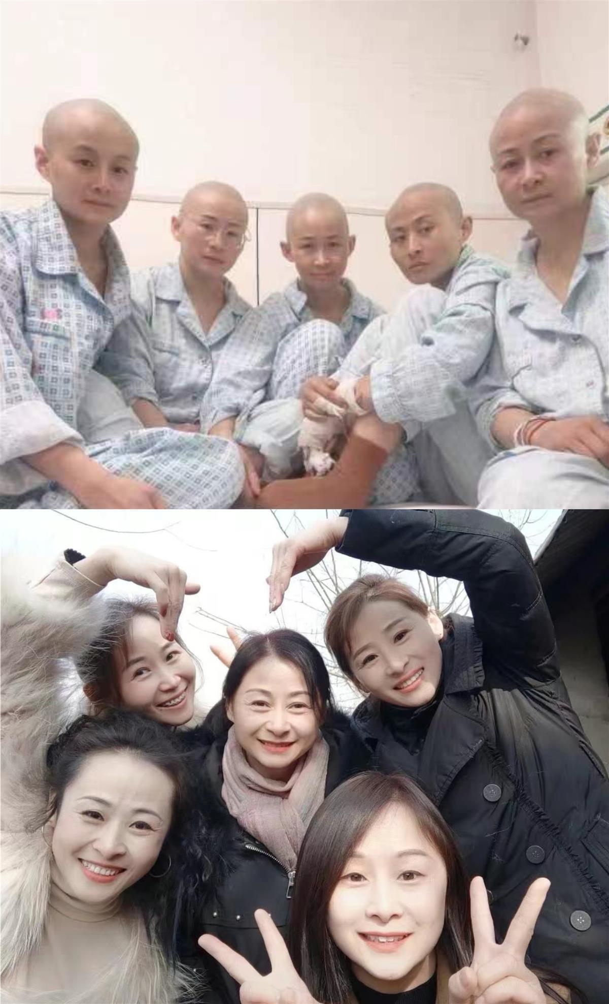 受伤姊弟的妈妈和四位阿姨剃头捐赠皮肤。（取材自极目新闻）