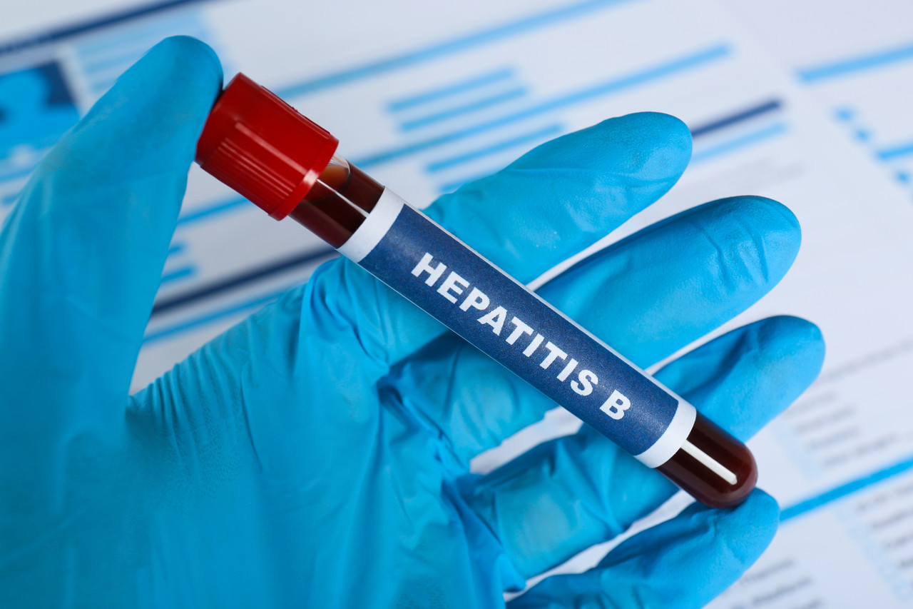 美国有58万至117万人感染B型肝炎，其中58%是亚裔；检测，是检查是否受到感染的唯一方法。(图／123RF)